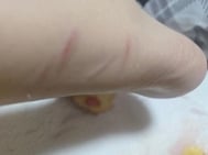 고양이 고양이 🐈‍⬛ 공격