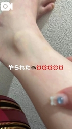 🐱 당했어요! ! 😇💢💢