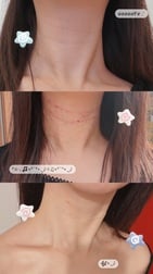 열람주의⚠️한국의 쁘띠 성형해 왔어♡